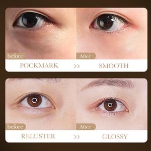 The Most Popular SADOER <strong>Snake</strong> <strong>Venom</strong> Peptide Multi-Effect Moisturizing <strong>Eye</strong> <strong>Cream</strong> for Improving Dark Circles - Product Image 4