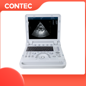 Ecografo Portatile CONTEC CMS1700B, Strumento Medico a Ultrasuoni 3D 4D con Doppler a Colori - Product Image 2