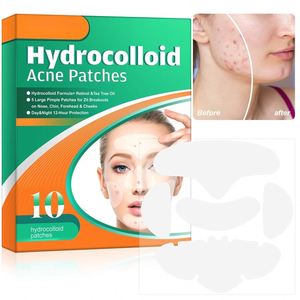 Elaimei Cerotti Idrocolloidali per il Trattamento di Brufoli e Acne 5 in 1 con Olio dell'Albero del Tè, Marchio Privato - Product Image 5