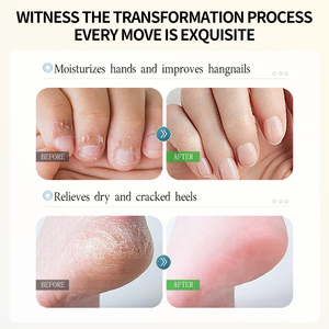OKADY ODM OEM OBM 40% CRÈME D'URÉE + 2% ACIDE SALICYLIQUE Hydrater <span class=keywords><strong>et</strong></span> Nourrir Crème Pour Le Corps pour Femmes Hommes <span class=keywords><strong>Pieds</strong></span> <span class=keywords><strong>et</strong></span> Main Protecteur De Soins De La Peau - Product Image 5