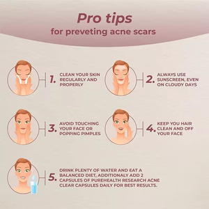 ハーブエキスサプリメントスキンケアにきびクレンジングビーガンにきびカプセル工場卸売 - Product Image 3