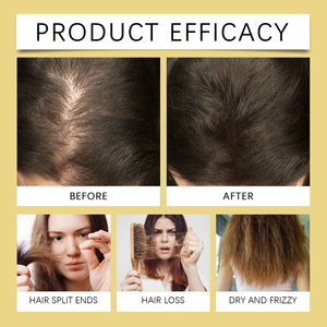 Huile de traitement capillaire hydratante et apaisante la mieux notée pour le soin des cheveux aux tresses résilientes et volumineuses - Product Image 4