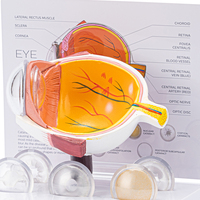Corneal Eye Medical Anatomical Human Corneal Disease Model TB-03 Human Cataract Eye Anatomical Model Interchangeable Lenses