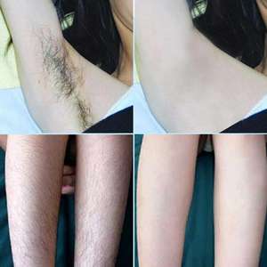 Crema Depilatoria Permanente per <span class=keywords><strong>Uomo</strong></span>, Rimozione Peli in 8 Minuti, Etichetta Privata, Vendita Calda in Pakistan - Product Image 5