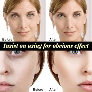 Collageen Draad Instant Lifting Anti-Aging Hydraterende Vloeibare Oplosbare Proteïne Serum Rimpelverwijderaar Gezichtsvuller Verstevigend - Product Image 5