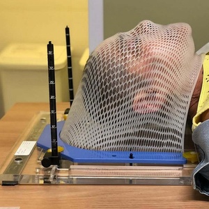 Máscara de Radioterapia Termoplástica con Marco en U para Oncología del Cáncer, Inmovilización de Cabeza CE ISO13485 - Product Image 1