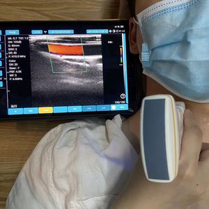 Harga pabrik 128 elemen nirkabel pemanjangan Linear jantung cembung 3-in-1 2-in-1 mesin pemindai <span class=keywords><strong>Ultrasound</strong></span> warna - Product Image 3