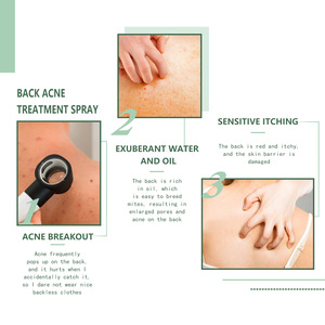 สเปรย์ดูแลหลัง บรรเทาผิวหลัง ทำความสะอาดผิวกาย ให้ผิวเรียบเนียน - Product Image 4