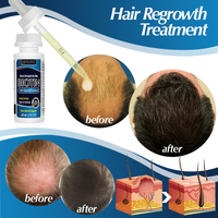 Produits de traitement de repousse des cheveux avec rouleau derma
