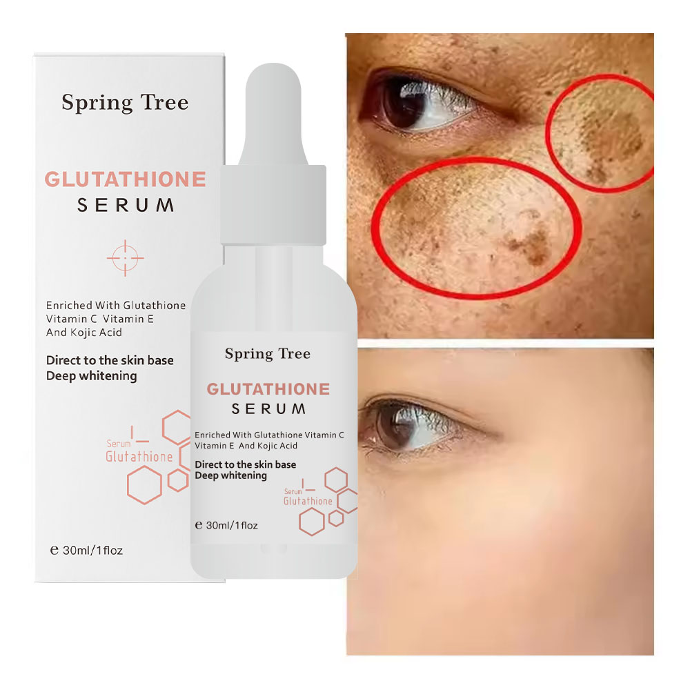 glutathione or kojic acid for skin whitening Korea Glutathione Kojic Acid Skincare Serum for Dark Spots
