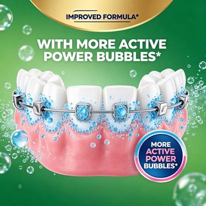 Tabletas Limpiadoras de Retenedores OEM, Limpieza Rápida en 3 Minutos para Alineadores <span class=keywords><strong>Invisalign</strong></span>, Dentaduras Postizas, Protectores Bucales, Cuidado Bucal, Marca Privada - Product Image 2