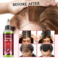 Minyak Penumbuh Rambut Bawang Merah Harga Pabrik dengan Minyak Jarak dan Argan, Serum Perawatan Kulit Kepala Anti Rontok, Minyak Rambut Grosir untuk Pertumbuhan Rambut