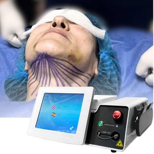 Máquina Endoláser de 980nm y 1470nm para Tratamiento de Acné Corporal y Nasal, Eliminación de <span class=keywords><strong>Arañas</strong></span> <span class=keywords><strong>Vasculares</strong></span>, Cirugía de Liposucción, Endolifting y Antienvejecimiento - Product Image 1