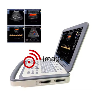 Sistem <span class=keywords><strong>Combo</strong></span> <span class=keywords><strong>Ultrasound</strong></span> Doppler hitam & putih Laptop - Product Image 1