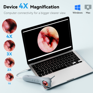 Q12-G destek PC gözlem kadar 128GB görsel Set hayvan kulak kameralar kulak kamera fotoğraf videoları HD otoskop ile silikon kılıf - Product Image 6