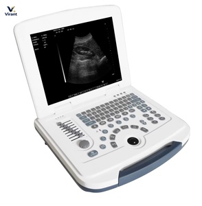 Sistema de Diagnóstico Ultrasónico Digital en Blanco y Negro para Animales, <span class=keywords><strong>Precio</strong></span> de Fábrica, Fabricante y Proveedor Veterinario - Product Image 3