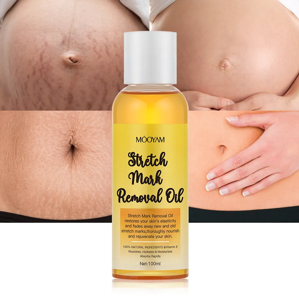 Private Label Biologische Stretch Mark Verwijderen Olie Aanpassen Behandeling Reparatie Anti Puistjes Acne Litteken Verwijderen Tummy Tuck Massage Olie