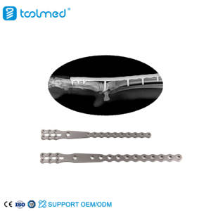 การปลูกถ่ายข้อต่อข้ออักเสบชนิดตรงของแผ่นล็อคข้อต่อข้อเข่าไทเทเนี่ยม - Product Image 1