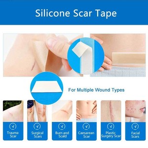KONLIDA Silicone Scar Sheets 10x2.5cm 12x3cm 7.5x5cm 15x3cm 12x10cm Medical Grade Breathable Wound Dressing - Product Image 5