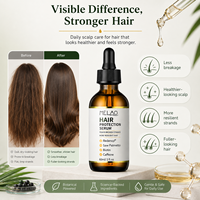 Sérum Capillaire Redensyl Marque Blanche avec Palmier Nain et Caféine pour la Croissance des Cheveux, Contre la Chute et pour la Protection du Cuir Chevelu