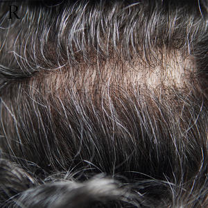 <span class=keywords><strong>Capelli</strong></span> Indiani Indetectabili di Alta Qualità con Base in PU per Extension <span class=keywords><strong>Uomo</strong></span> Ritagliabile su Misura Supporto Personalizzazione Nodo Invisibile 1B - Product Image 5