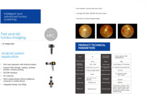กล้องเรติน่าแบบมือถืออุปกรณ์ด้านจักษุวิทยา - Product Image 3
