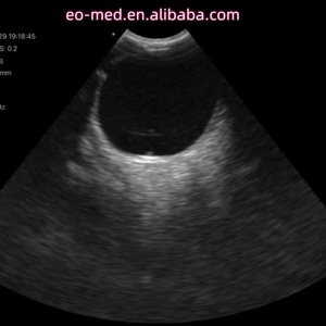 Escáner de Ultrasonido Oftálmico Inalámbrico Portátil CU110 USB y Wifi, Sonda Doppler a Color con Carro para iPad - Product Image 5