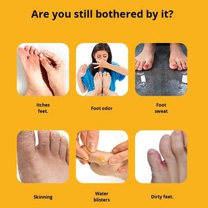 Venta al por mayor mata bacterias y refresca el olor; previene hongos y alivia la fatiga. Spray desodorante para pies después del <span class=keywords><strong>ejercicio</strong></span> - Product Image 3