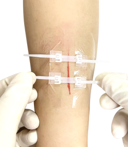 Kesim bakım cihazı için sütür olmadan yara kapatma şeritleri yapışkan bandajlar cerrahi dikiş şeritleri kiti - Product Image 3