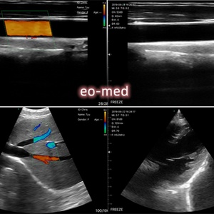 Two Probes Portable <b>Wireless</b> Ultrasound Scanner Probe/ USG Scanner Machine Price - Product Image 5