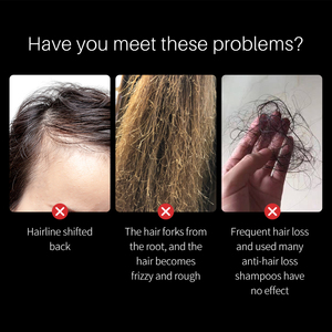 Tonico biologico per <span class=keywords><strong>acqua</strong></span> di riso nero anti perdita prodotti naturali selvatici con etichetta privata trattamento a crescita rapida olio siero spray per capelli - Product Image 2