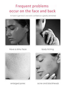 Jabón Artesanal Natural y Orgánico para Blanquear la Piel con Aceite Esencial de Rosa y Flores Secas - Aclarante, Antiséptico y Portátil para el Rostro - Product Image 5