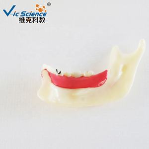 Modelo Dental Anatómico de Dientes Posteriores Inferiores Derechos en Resina y PVC para Educación en Ciencias Médicas en Escuelas y Hospitales - Product Image 2