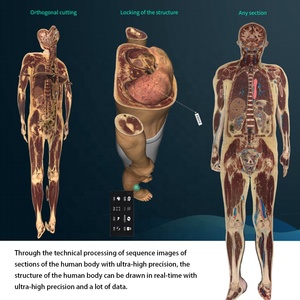 Tavolo per Autopsia Virtuale 3D Anatomage Sistema Digitale di Anatomia del Corpo Umano per <span class=keywords><strong>Università</strong></span> - Product Image 5