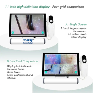 Detector de piel de cuero cabelludo HD de cuatro espectros Analizador de folículos pilosos Analizador de detección facial HD Multifuncional - Product Image 4