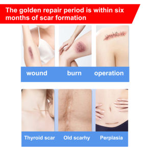 Sérum de traitement des cicatrices DR.DAVEY avec du rétinol A et de la vitamine B5, parfumé, 100% pur, pour tous types de cicatrices, 50 ml - Product Image 2