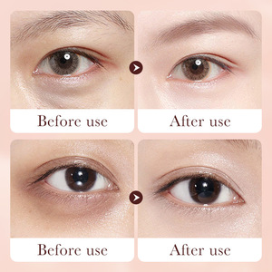 Sadoer - Barra <span class=keywords><strong>de</strong></span> Crema <span class=keywords><strong>Contorno</strong></span> <span class=keywords><strong>de</strong></span> <span class=keywords><strong>Ojos</strong></span> 3g, Hidratante, Reafirmante, Antiarrugas, con Retinol, para Líneas Finas y Aclarar la Piel - Product Image 6