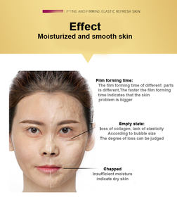 Y OEM/ODM Korea <span class=keywords><strong>Miracle</strong></span> Witch Mascarilla de enzima de elevación facial Lifting Reafirmante V Shaping Face Escultura Máscara de contorno - Product Image 3