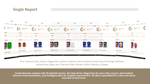 2026 Analyse-System Spiegel-Tester Scanner KI-Gesichts-Hautanalysator - Product Image 5