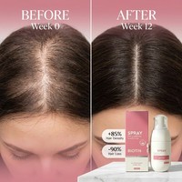 Semprotan Penumbuh Rambut Vegan Organik Keratin Biotin Private Label, Anti-Rontok, Memperkuat Akar, 2%