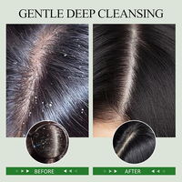 Shampoing-Gommage 2-en-1 Menthe Romarin Marque Blanche, Nettoyant et Rafraîchissant Profond pour Cuir Chevelu, Réduit les Pellicules