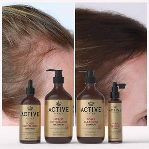 Oemレッドオニオンシャンプー脱毛成長コンディショナーメーカーヘアケア製品ローズマリシャンプー - Product Image 5