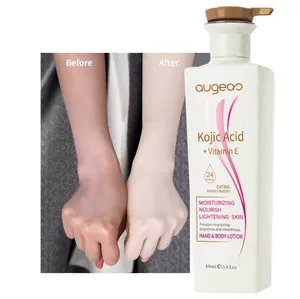 Customization Organic Kojic Acid Vitamin E Natural Lightening Moisturizing Nourishing Skin Hand Whitening Body Lotion Cream