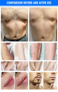 Portable 2000W Diode Laser Machine 10 Bar Professionnel Électrolyse Permanente Épilation Rajeunissement De La Peau - Product Image 6