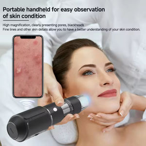 Portable 1000x HD Wireless Digital <b>Microscope</b> Portable Wifi Dermatoscope for Studies - Product Image 5