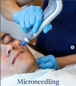 <span class=keywords><strong>Dermapen</strong></span> RF <span class=keywords><strong>4</strong></span> pour usage domestique et professionnel, DermapenWorld, traitement de micro-aiguilletage, micro-aiguilles 16 points, aiguilletage cutané - Product Image 1