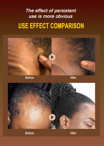 Prodotti per la cura dei capelli Private Label riparazione capelli danneggiati trattamento nutriente Batana olio per la crescita dei capelli puro biologico naturale a - Product Image 5