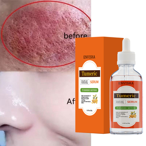 Etiqueta privada Orgánica Vegana Nutritiva <span class=keywords><strong>Borrador</strong></span> <span class=keywords><strong>de</strong></span> manchas oscuras Iluminador Incluso Blanqueamiento Suero facial <span class=keywords><strong>de</strong></span> cúrcuma - Product Image 1