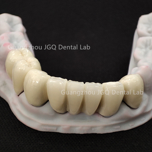Ponts et couronnes en céramique en métal PFM laboratoire dentaire chinois meilleur <span class=keywords><strong>prix</strong></span> de fabrication bon marché - Product Image 2