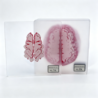 Plaque carrée vierge en acrylique sur le thème de l'anatomie du cerveau, impression HD personnalisée, section transversale du cerveau humain, ornement de bureau pour l'enseignement médical